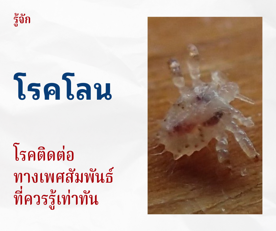 รู้จักโรคโลน โรคติดต่อทางเพศสัมพันธ์ที่ควรรู้เท่าทัน
