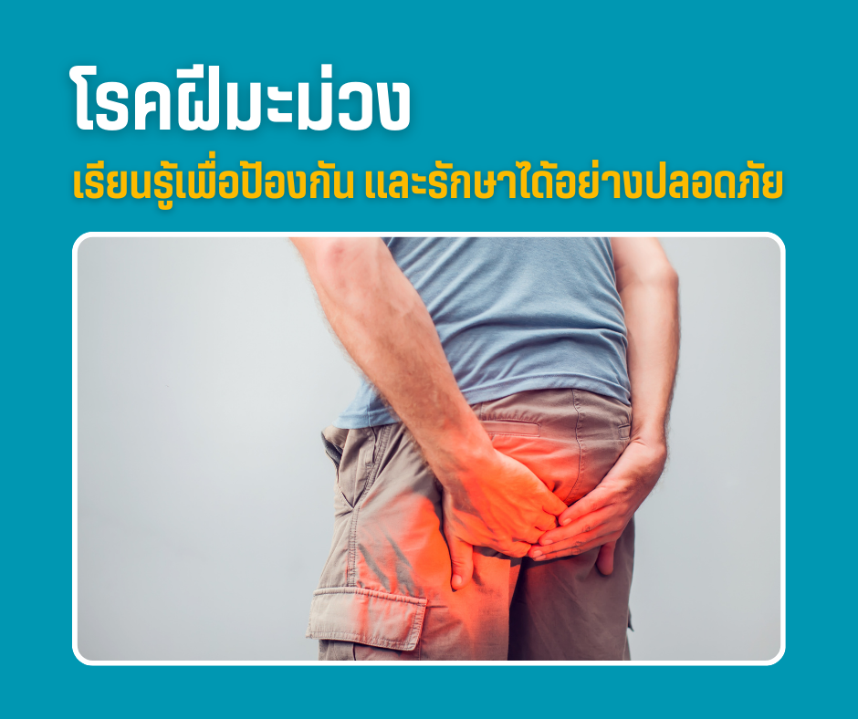 โรคฝีมะม่วง เรียนรู้เพื่อป้องกัน และรักษาได้อย่างปลอดภัย