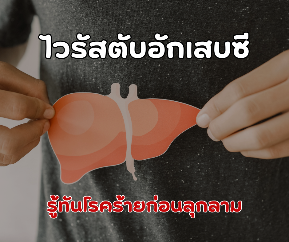 ไวรัสตับอักเสบซี รู้ทันโรคร้ายก่อนลุกลาม
