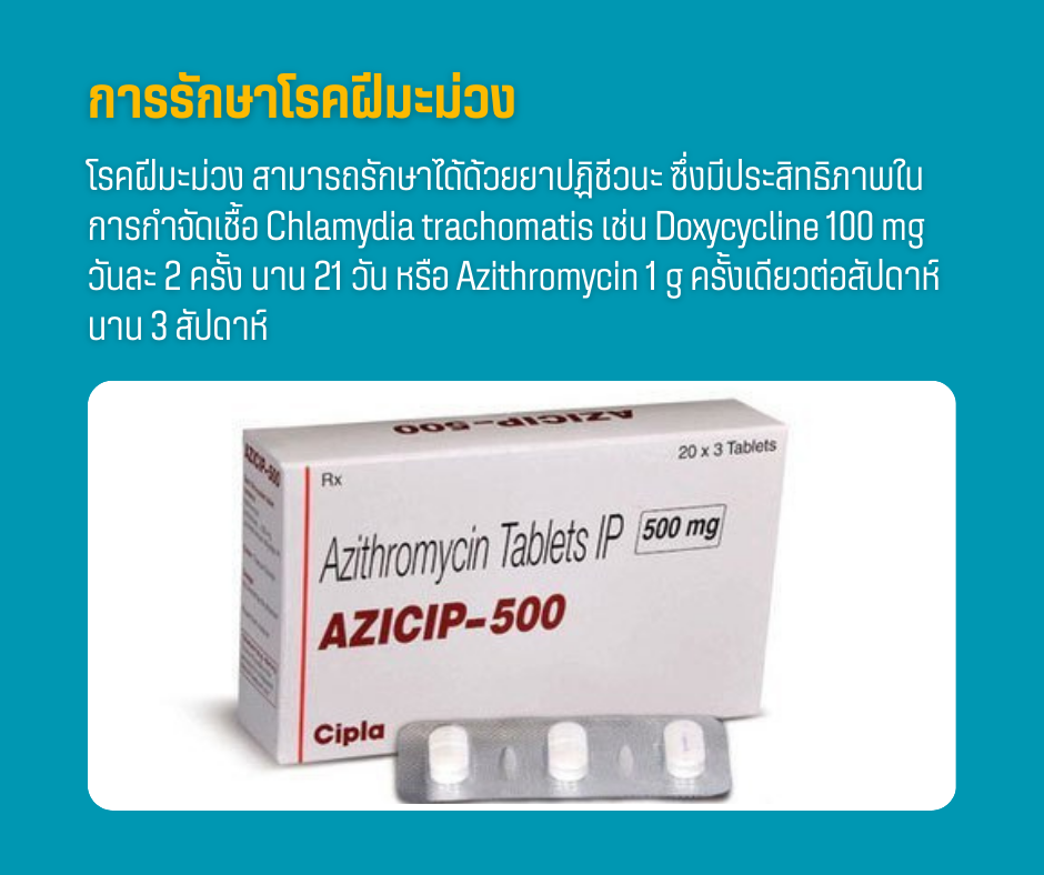 การรักษาโรคฝีมะม่วง