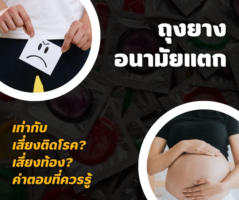 ถุงยางอนามัยแตก = เสี่ยงติดโรค? เสี่ยงท้อง? คำตอบที่ควรรู้