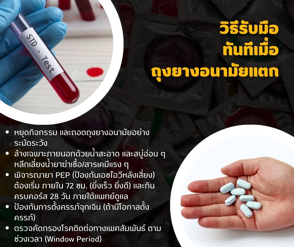 วิธีรับมือ ทันทีเมื่อ ถุงยางอนามัยแตก