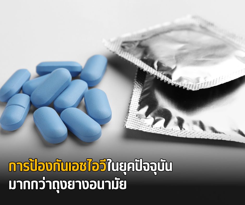 การป้องกันเอชไอวีในยุคปัจจุบัน มากกว่าถุงยางอนามัย