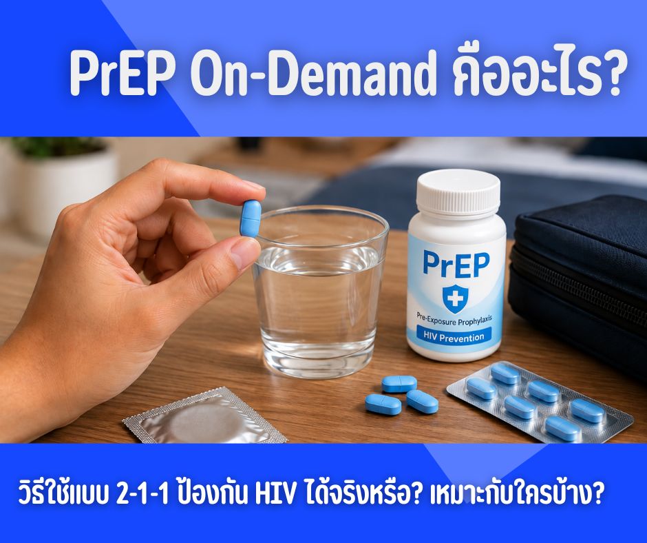 PrEP On-Demand คืออะไร? วิธีใช้แบบ 2-1-1 ป้องกัน HIV ได้จริงหรือ? เหมาะกับใครบ้าง?